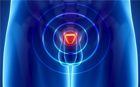 前列腺痛的诊断检查方法